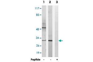 Western blot analysis of extracts from K-562 cells (Lane 1) and RAW 264. (HOXD10 Antikörper)