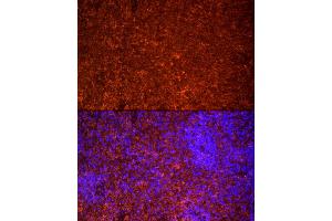 Immunofluorescence analysis of rat spleen cells using TLR7 Rabbit pAb (ABIN3021246, ABIN3021247, ABIN3021248 and ABIN6214083) at dilution of 1:25 (40x lens). (TLR7 Antikörper  (AA 30-230))