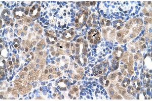 Human kidney (SLC46A3 Antikörper  (N-Term))