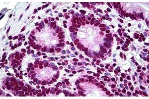 Human Small Intestine: Formalin-Fixed, Paraffin-Embedded (FFPE) (LHX1 Antikörper  (AA 1-101))