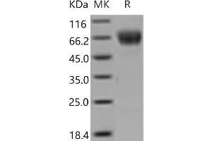 Western Blotting (WB) image for C-Type Lectin Domain Family 4, Member F (CLEC4F) protein (ABIN7194488) (CLEC4F Protein)