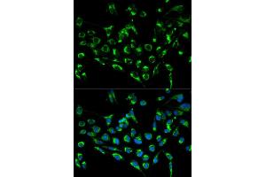 Immunofluorescence analysis of MCF7 cell using CDKN3 antibody. (CDKN3 Antikörper)