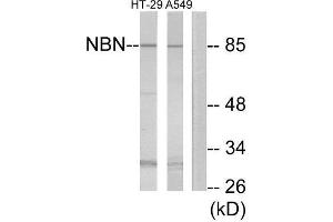 Western Blotting (WB) image for anti-Nibrin (NBN) (Internal Region) antibody (ABIN1850486) (Nibrin Antikörper  (Internal Region))