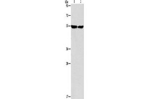 Western Blotting (WB) image for anti-Integrin-Linked Kinase (ILK) antibody (ABIN2428282) (ILK Antikörper)