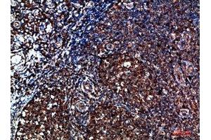 Immunohistochemical analysis of paraffin-embedded human-tonsil, antibody was diluted at 1:200 (CYFIP2 Antikörper  (AA 1171-1220))