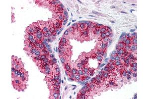 Anti-cIAP1 antibody IHC of human prostate. (BIRC2 Antikörper  (C-Term))