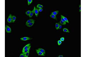 Immunofluorescence staining of HepG2 cells with ABIN7171957 at 1:400, counter-stained with DAPI. (TGFBR1 Antikörper  (AA 157-244))