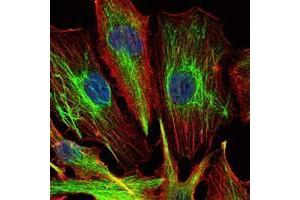 Immunofluorescence analysis of U251 cells using KLHL22 antibody (green). (KLHL22 Antikörper)