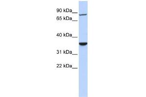 WB Suggested Anti-RNF207 Antibody Titration:  0. (RNF207 Antikörper  (N-Term))