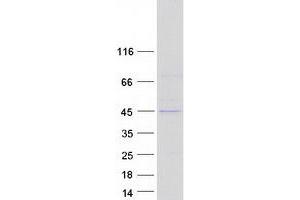 Western Blotting (WB) image for Ribonucleotide Reductase M2 B (TP53 Inducible) (RRM2B) protein (Myc-DYKDDDDK Tag) (ABIN2731210)