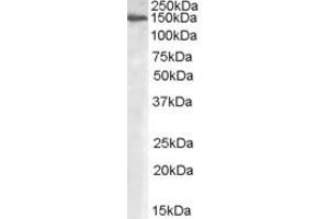 Western Blotting (WB) image for anti-Mannosidase, Alpha, Class 2A, Member 1 (MAN2A1) (Internal Region) antibody (ABIN2465922) (alpha-Mannosidase II Antikörper  (Internal Region))