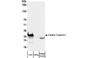 Western Blotting (WB) image for anti-Cardiac Troponin I (TNNI3) antibody (ABIN7795608) (TNNI3 Antikörper)