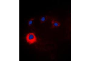 Immunofluorescent analysis of NOTCH1 staining in HeLa cells.