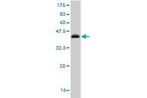 Western Blot detection against Immunogen (35. (RORB Antikörper  (AA 136-224))