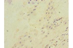 Immunohistochemistry of paraffin-embedded human placenta tissue using ABIN7156500 at dilution of 1:100 (ITGB8 Antikörper  (AA 43-320))