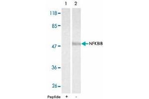 Western blot analysis of extracts from 293 cells using NFKBIB polyclonal antibody . (NFKBIB Antikörper)