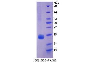 SDS-PAGE (SDS) image for Myoglobin (MB) (AA 1-154) protein (His tag) (ABIN1080353) (Myoglobin Protein (MB) (AA 1-154) (His tag))