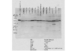 Western blot analysis of Rat tissue mix showing detection of PDI protein using Rabbit Anti-PDI Polyclonal Antibody . (P4HB Antikörper  (AA 409-509) (Atto 488))