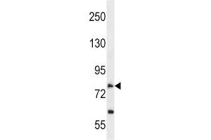 Western Blotting (WB) image for anti-Solute Carrier Family 28 (Sodium-Coupled Nucleoside Transporter), Member 2 (SLC28A2) antibody (ABIN2998577) (SLC28A2 Antikörper)