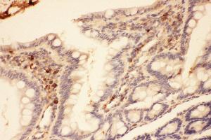 Anti-MMP7 Picoband antibody,  IHC(P): Rat intestines Tissue (MMP7 Antikörper  (AA 95-264))