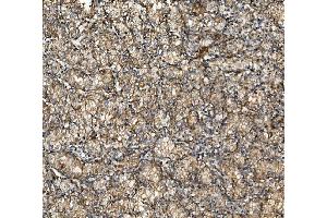 IHC analysis of NSF using anti-NSF antibody (ABIN7601630). (NSF Antikörper  (AA 4-636))