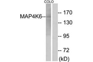 Western blot analysis of extracts from COLO cells, using MAP4K6 Antibody. (MAP4K6 Antikörper  (AA 401-450))