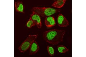 IF analysis of VPRBP/DCAF1 using anti-VPRBP/DCAF1 antibody (ABIN7602005). (DDB1 and CUL4-Associated Factor 1 (DCAF1) (AA 540-861) Antikörper)