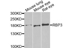 Western blot analysis of extracts of various cell lines, using RBP3 antibody. (RBP3 Antikörper)