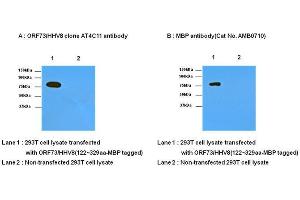 Transfected and non-transfected 293T cell lysates were resolved by SDS-PAGE, transferred to nitrocellulose membrane and probed with anti- ORF73/HHV8 (1:1,000) and anti-MBP (1:1,000). (HHV 8 (AA 122-329) Antikörper)