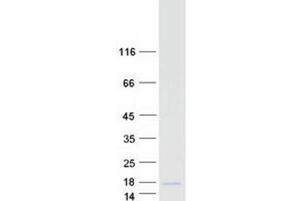 CALCB Protein (Myc-DYKDDDDK Tag)