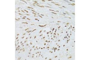 Immunohistochemistry of paraffin-embedded human uterus using DDB1 Antibody. (DDB1 Antikörper)