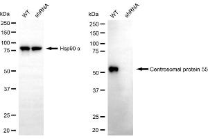 Western blotting analysis using centrosomal protein 55 antibody (ABIN7798025). (CEP55 Antikörper)