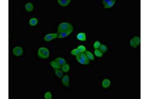 Immunofluorescent analysis of PC-3 cells using ABIN7169471 at dilution of 1:100 and Alexa Fluor 488-congugated AffiniPure Goat Anti-Rabbit IgG(H+L) (SH3TC2 Antikörper  (AA 188-427))