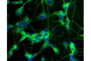 Immunofluorescent staining of differentiated SH-SY5Y cells. (MAP2 Antikörper  (AA 19-219))