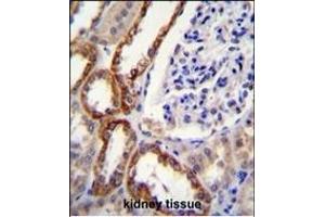 Immunohistochemistry (Paraffin-embedded Sections) (IHC (p)) image for anti-Prolyl-tRNA Synthetase 2, Mitochondrial (Putative) (PARS2) (AA 390-417), (C-Term) antibody (ABIN6242575)