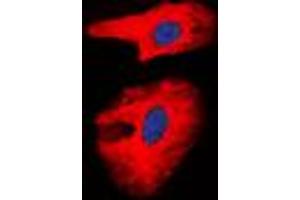 Immunofluorescent analysis of Collagen 1 alpha 2 staining in A431 cells. (COL1A2 Antikörper  (Center))