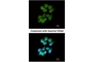 ICC/IF Image Immunofluorescence analysis of methanol-fixed A431, using Slap, antibody at 1:200 dilution. (SLA Antikörper)