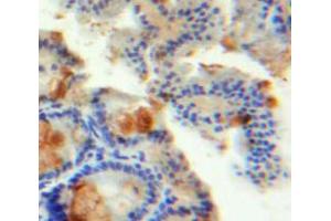 Used in DAB staining on fromalin fixed paraffin-embedded Intestine tissue (INSL5 Antikörper  (AA 23-135))