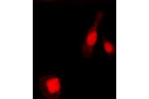 Immunofluorescence (IF) image for anti-Nuclear Factor of kappa Light Polypeptide Gene Enhancer in B-Cells 1 (NFKB1) (pSer337) antibody (ABIN7301060)
