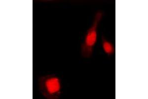 Immunofluorescent analysis of NF-kappaB p105/p50 (pS337) staining in MCF7 cells. (NFKB1 Antikörper  (pSer337))