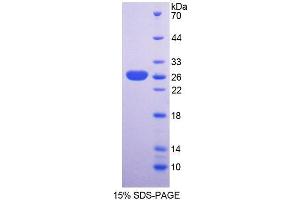 SDS-PAGE analysis of Mouse SNAG1 Protein. (SNX18 Protein)