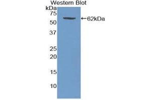 Western Blotting (WB) image for anti-Wingless-Type MMTV Integration Site Family, Member 5A (WNT5A) (AA 62-380) antibody (ABIN3210025) (WNT5A Antikörper  (AA 62-380))