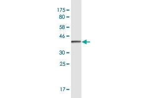 Western Blot detection against Immunogen (36. (CUX2 Antikörper  (AA 121-220))