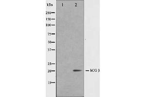 Western blot analysis on NIH-3T3 cell lysate using hCG beta Antibody,The lane on the left is treated with the antigen-specific peptide. (HCG beta Antikörper)