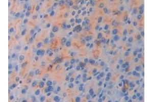 IHC-P analysis of Mouse Pancreas Tissue, with DAB staining. (IL18R1 Antikörper  (AA 182-336))