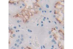 IHC-P analysis of Human Tissue, with DAB staining. (IL12RB1 Antikörper  (AA 429-603))