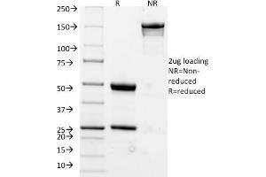 SDS-PAGE (SDS) image for anti-Membrane-Spanning 4-Domains, Subfamily A, Member 1 (MS4A1) antibody (ABIN6941107)