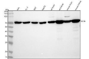 Western blot analysis of SDHA using anti-SDHA antibody (ABIN7606254).