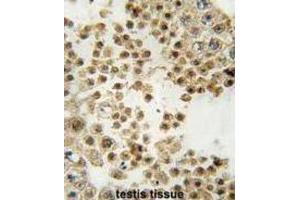 Immunohistochemistry (IHC) image for anti-Parkinson Protein 2, E3 Ubiquitin Protein Ligase (Parkin) (PARK2) antibody (ABIN3002636) (Parkin Antikörper)
