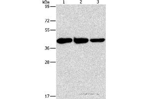 Western blot analysis of Human normal liver tissue, mouse brain and heart tissue, using GOT1 Polyclonal Antibody at dilution of 1:1600 (GOT1 Antikörper)
